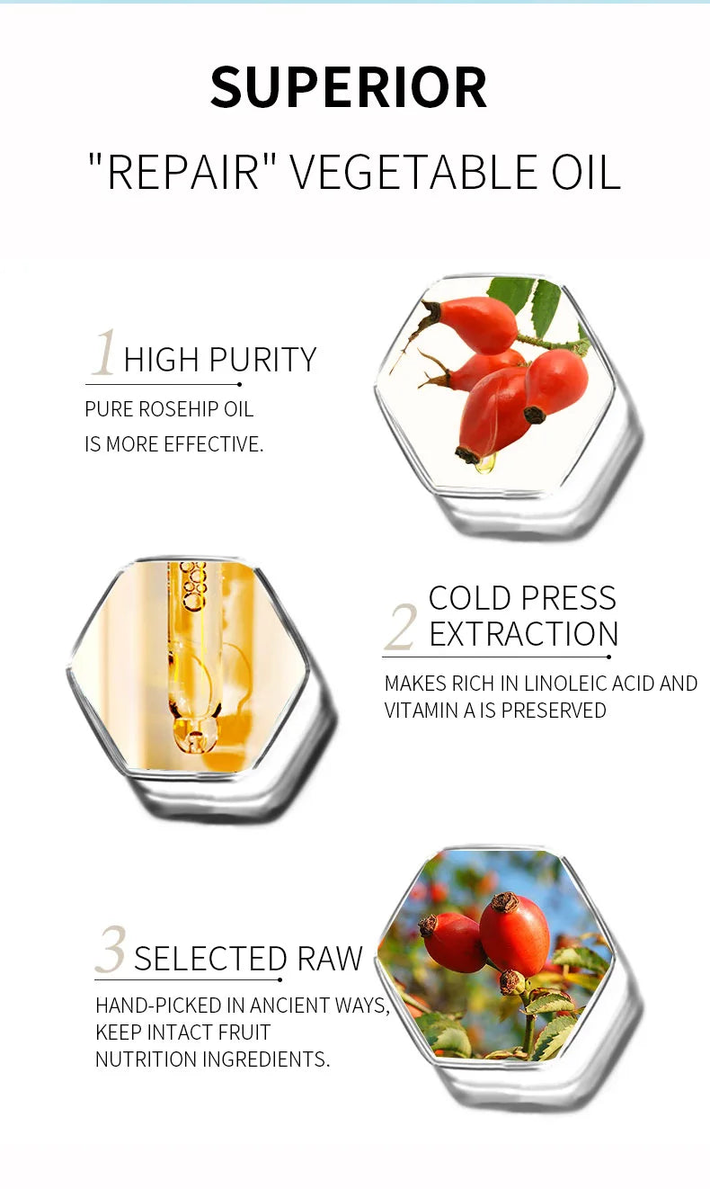 Organic Rosehip Oil Antioxidant Improve Fine Lines Wrinkles Firming Lifting Repair Moisturizer Nourish Smooth Hair Skin Care Oil
