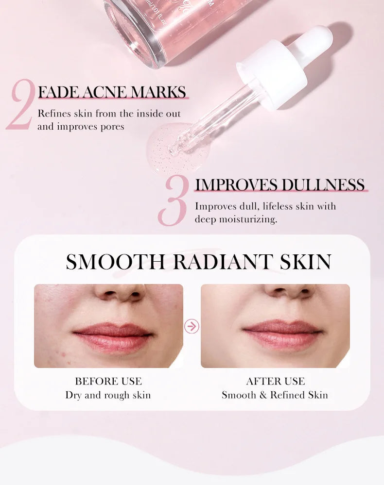 Niacinamide Serum Dark Spot Remover Fade Acne Marks Hyperpigmentation Shrink Pores Even Skin Tone Moisturizing Korea Skin Care 3